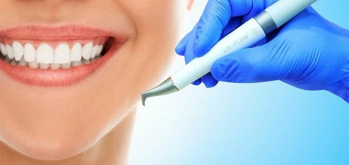 Ultrasonic cleaning with Air Flow dentist Maxim Ruda in Odessa. Sign up for the promotion.
