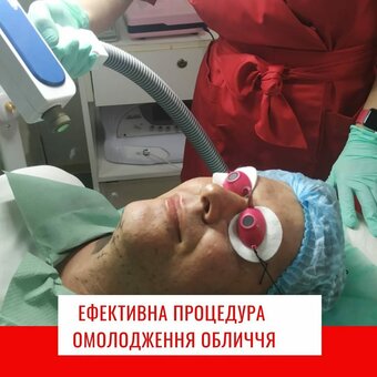 Омоложение лица