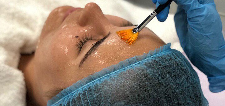 Up to 3 sessions of laser carbon facial peeling at the Face&Body center with a 2% discount