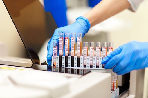 Лабораторія «Invitro». Знижки на аналізи
